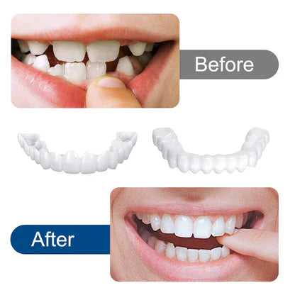 Snap on Smile Teath Covers For Men And Women perfect smile